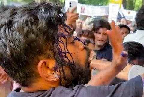 Cockroach Janata Party (CJP) founder Abhijeet Dipke reacts after a woman threw an ink-like liquid on him as he begins an indefinite hunger strike at Jantar Mantar, in New Delhi.