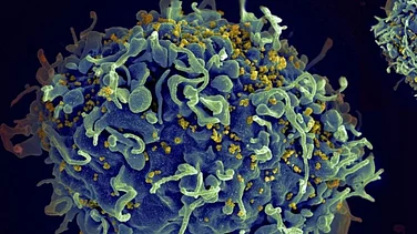 WHO/© S. Pincus, E. Fischer and A. Athman, National Institute of Allergy and Infectious Diseases/NIH