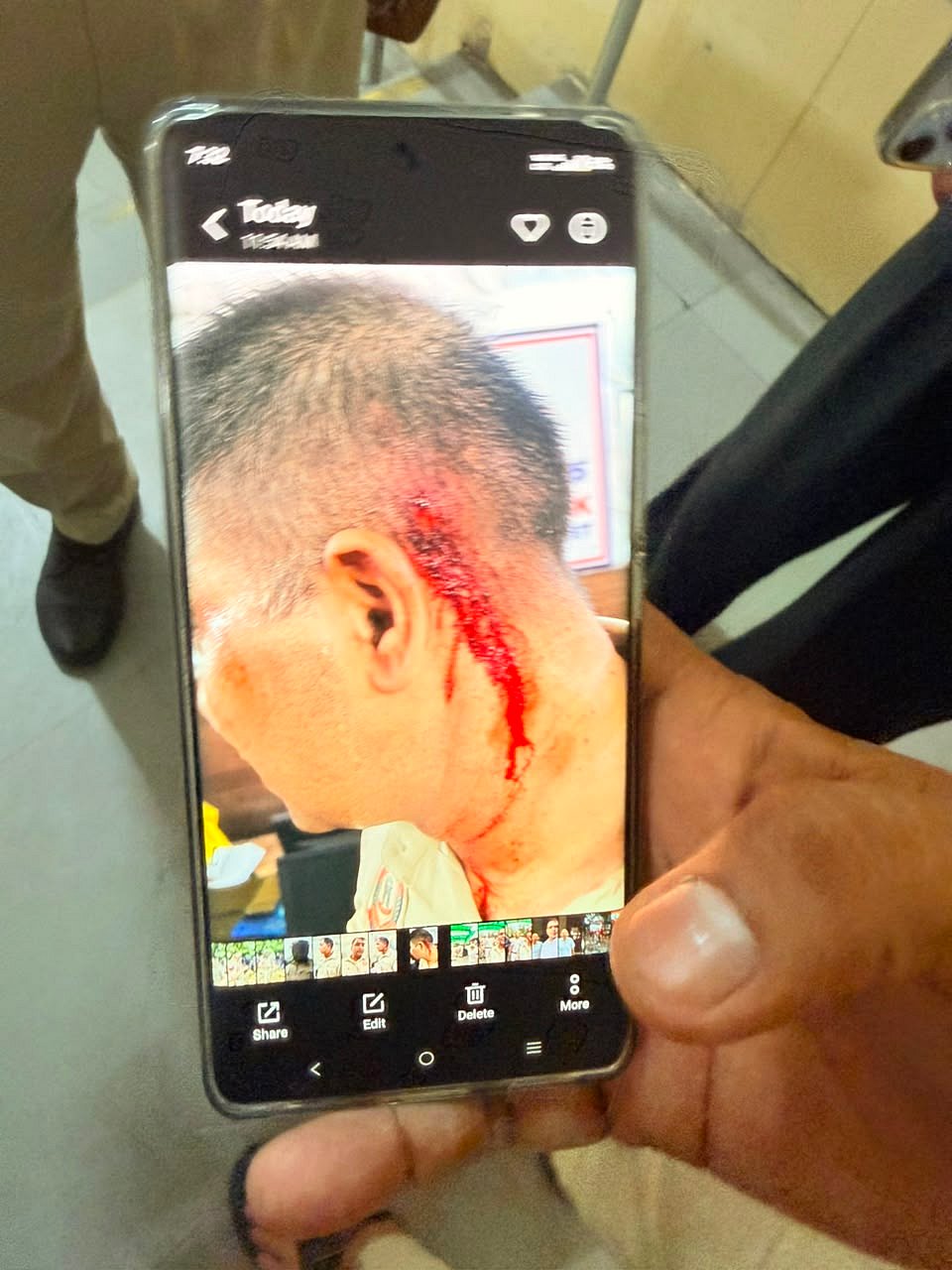 One of the police personnel who was injured. 