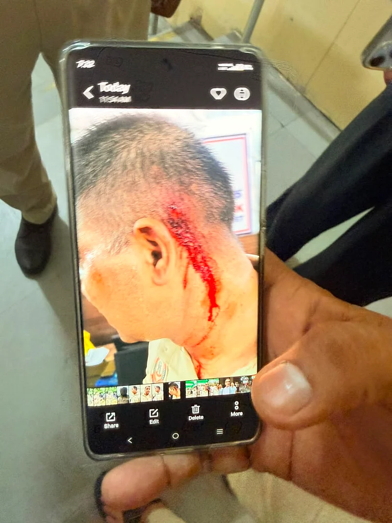 One of the police personnel who was injured.
