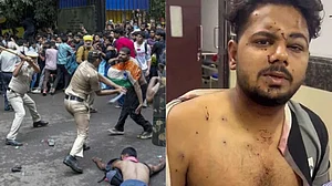 Outlook India : A 25-year-old protester displays injuries allegedly sustained during the July 20 CJP protest crackdown.