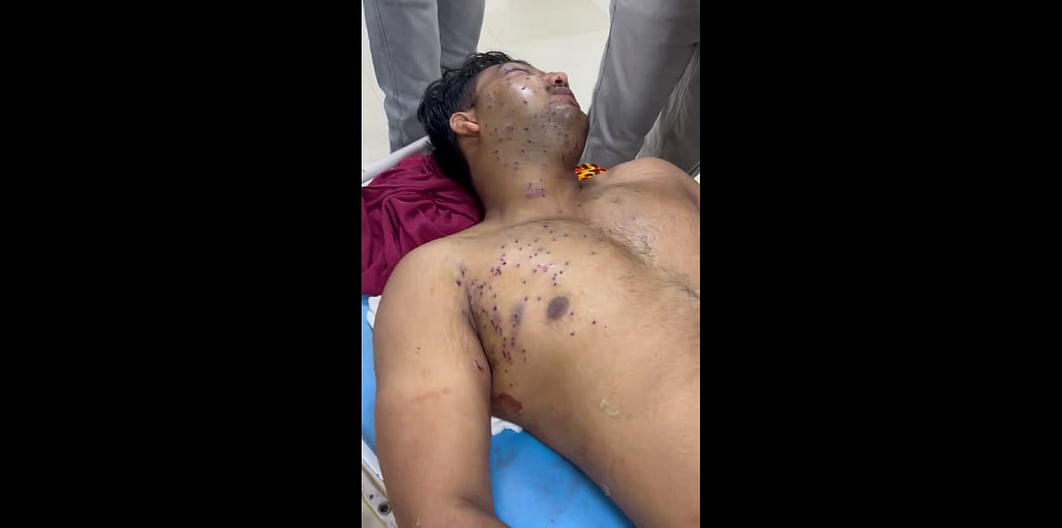 Screen grab from X showing a protester with injuries shared by CJP spokesperson Saurav Das. - Saurav Das/X