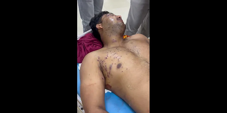 Screen grab from X showing a protester with injuries shared by CJP spokesperson Saurav Das. - Saurav Das/X