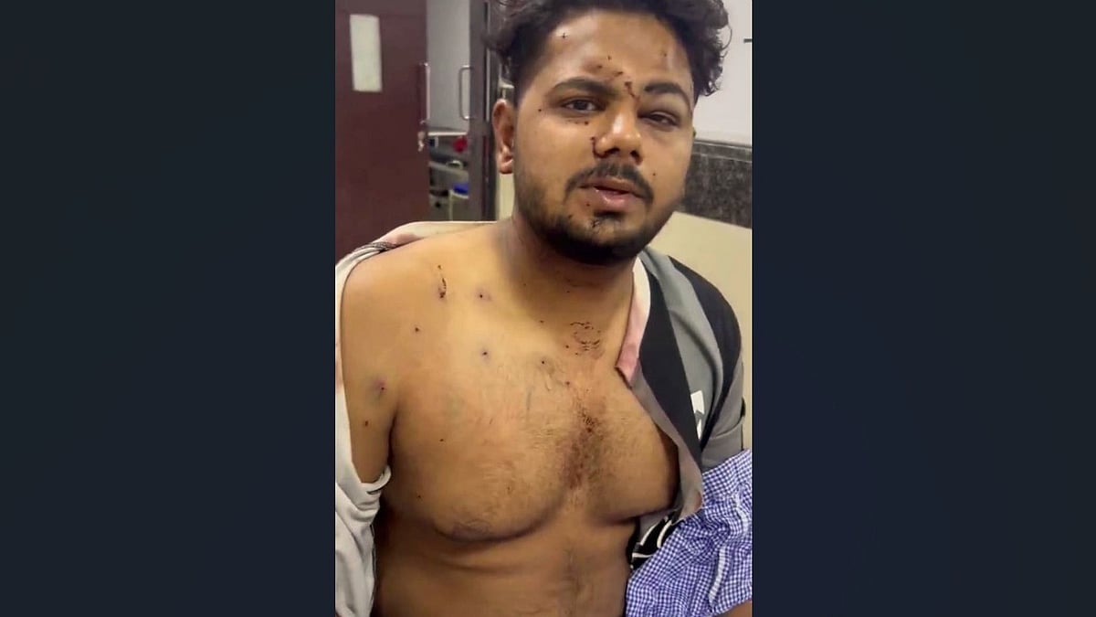 A 25-year-old protester displays injuries allegedly sustained during the July 20 CJP protest crackdown. - Outlook India