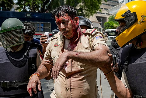 An injured police official being taken following stone-pelting amid the ongoing protest of Cockroach Janta Party (CJP) demanding the resignation of union education Minister Dharmendra Pradhan over the NEET paper leak issue, at Jantar Mantar, in New Delhi, Saturday, July 25, 2026. 