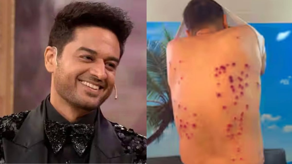 Khatron Ke Khiladi Maker Reacts to Gaurav Khanna’s Injuries - Instagram