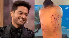 Khatron Ke Khiladi Maker Reacts to Gaurav Khanna’s Injuries - Instagram