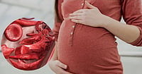 Sickle Cell Burden In Pregnancy Exposes Gaps In Early Screening, Family Testing