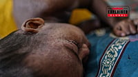 | Photo: AP/Mahmud Hossain Opu : How Years Of Immunisation Gaps Set The Stage For Bangladesh’s Measles Surge