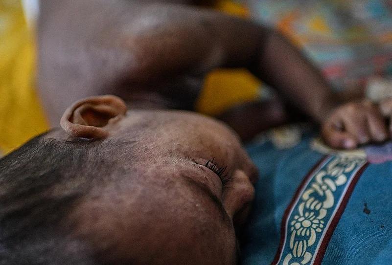 Measles hotspots Bangladesh