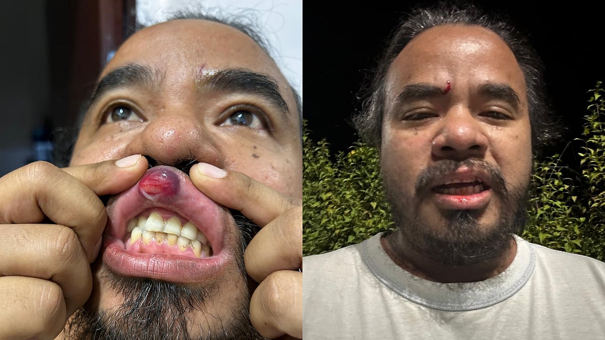 Dominic Sangma attacked