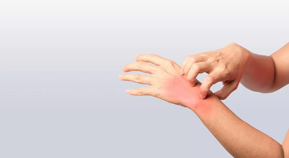 Climate Change Raises Skin Disease Risks Worldwide: Study