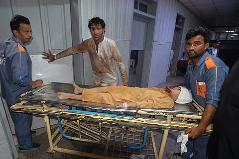 Workers and a volunteer transport a boy injured in the roof collapse of a private school, at a hospital in Peshawar, Pakistan, Thursday, Oct. 15, 2026.