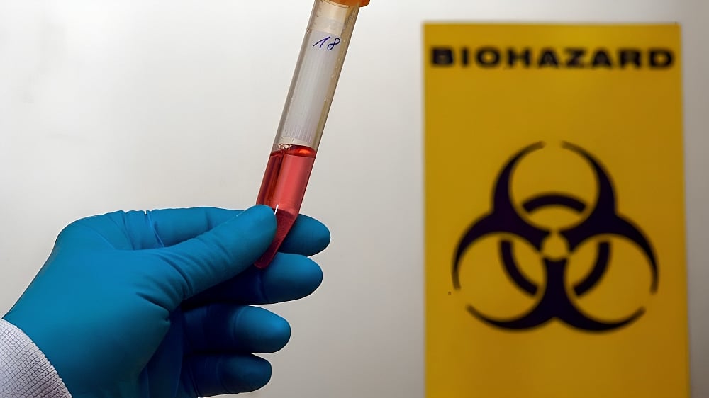 France has reported its first known human case of Shamonda virus after a severely immunocompromised patient died in early October. - X