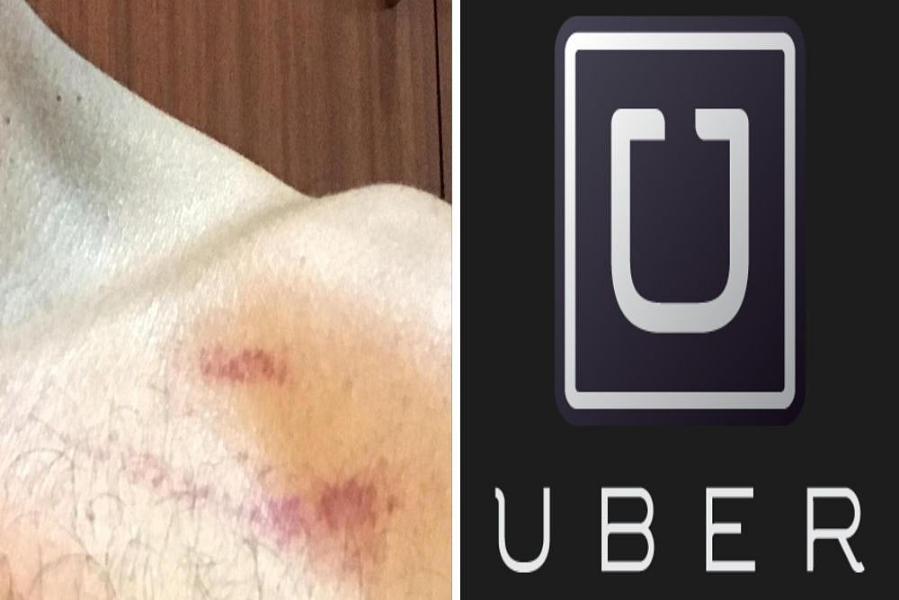 Bengaluru-Based CEO Thrashed Allegedly By More Than 20 Uber Drivers Over Rear Seat Belts
