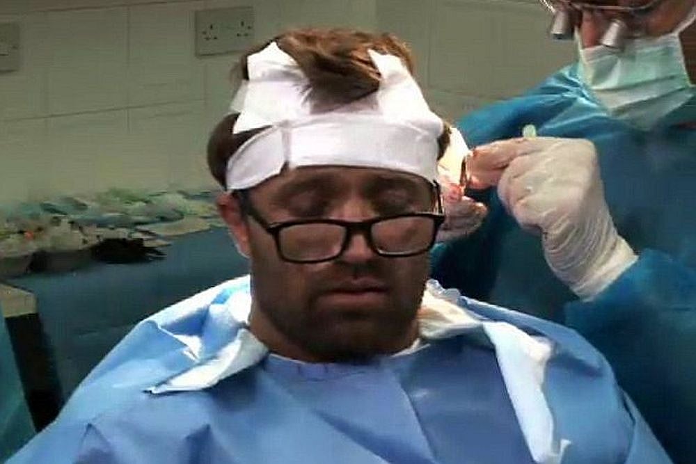 Why Are There So Many Bandaged Heads In Istanbul?