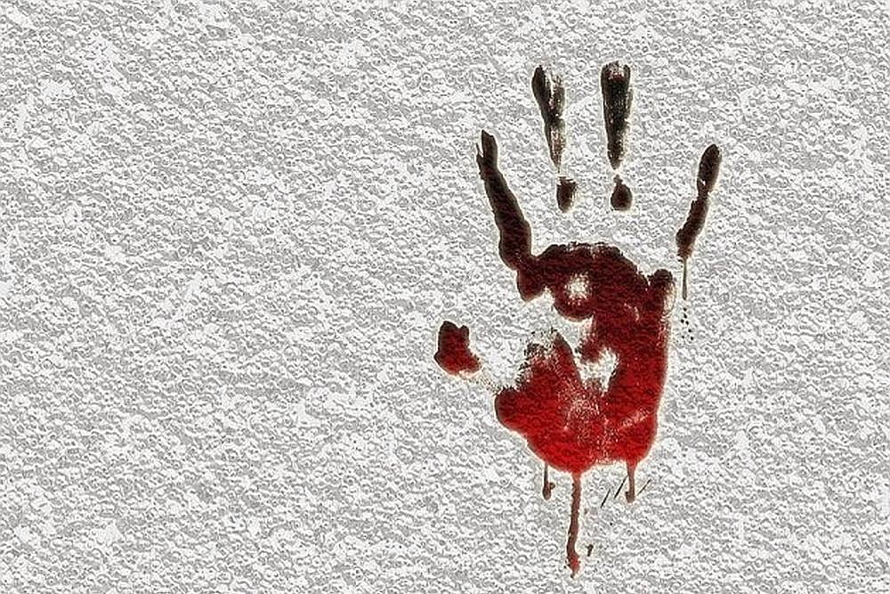 Hyderabad Man `Chops Off Sons Hand Angered By His Cell Phone Addiction