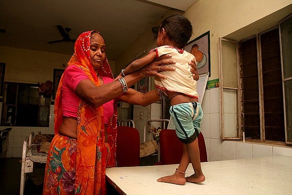 India Must Brace For A Massive Spike In Malnutrition Post Covid