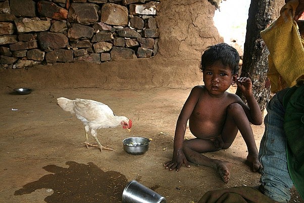 A child suffering from malnutrition in Baran district, Rajasthan. According to a report, India has one-third of worlds stunted children