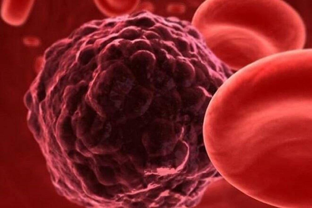 AI Could Help Better Predict Mouth Cancer Risk, UK Scientists Say