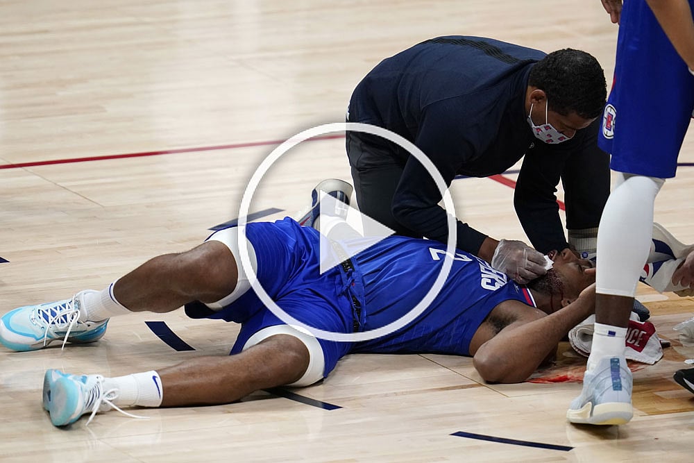NBA: Kawhi Leonard Facial Injury 'Was Kind Of Scary' - VIDEO