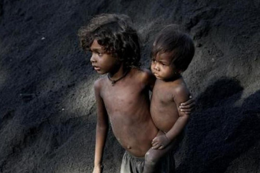 6.7 M Children Under 5 Could Suffer From Wasting Due To COVID-19