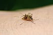 The Pivotal Role Of Nutrition In Controlling Lymphatic Filariasis (Elephantiasis)