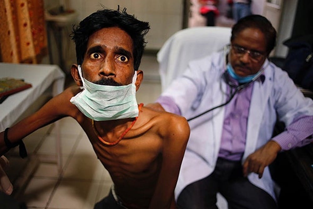Covid-19 And Lockdown: A Double Whammy For Tuberculosis Patients in India