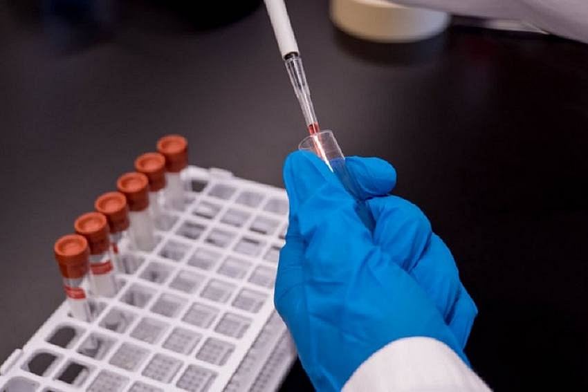 Will Covid Vaccines Provide Life-Long Protection? This Is What We Know So Far