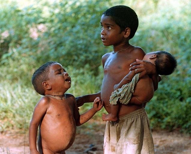 Anemia: Consequence Of Intergenerational Malnutrition