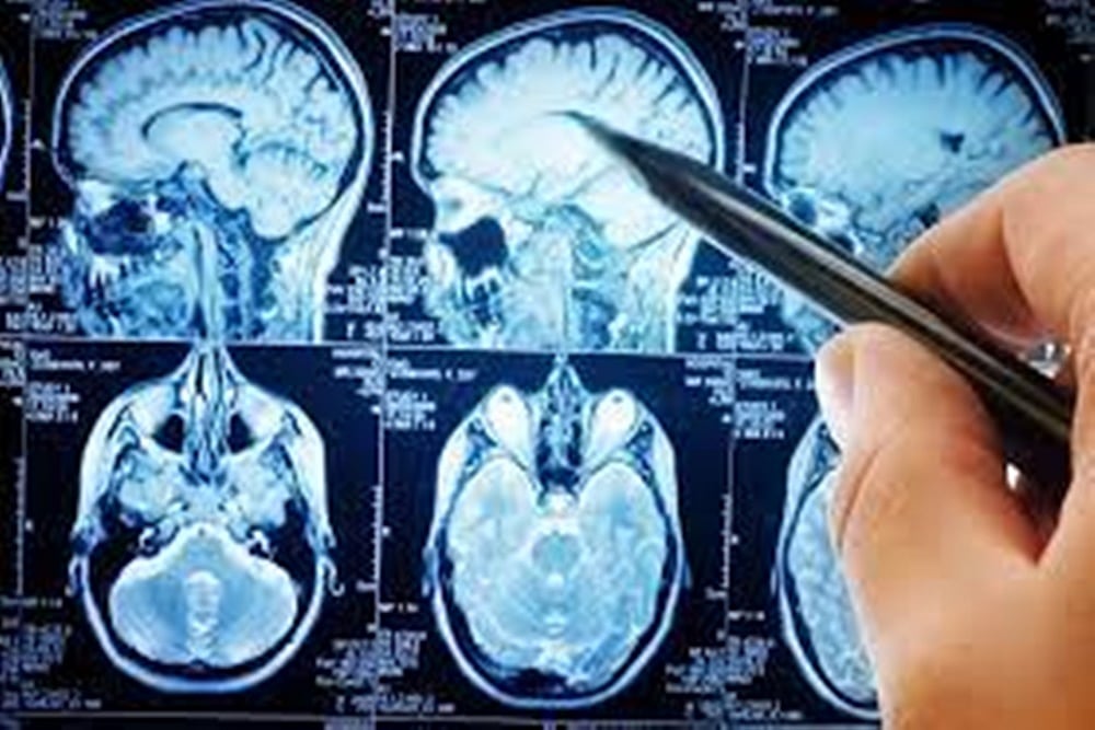 How Can You Identify Brain Tumor Early?