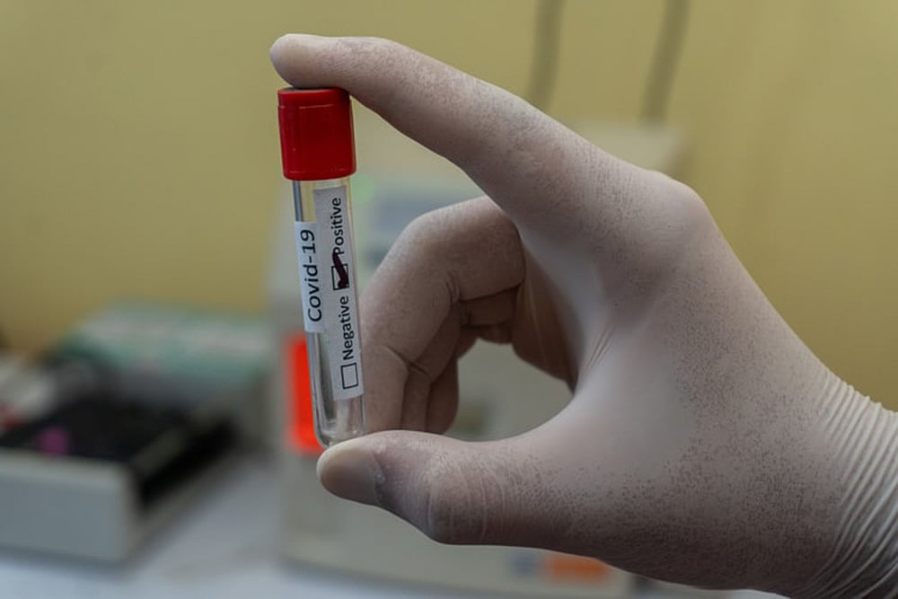Kerala-Based Medico, Who Was India’s First Covid Patient, Tests Positive A Second Time