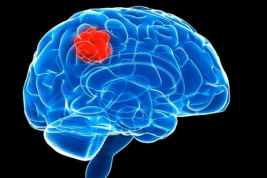 Neurological Cases Surging Among Post-Covid Patients: Delhi Private Hospital