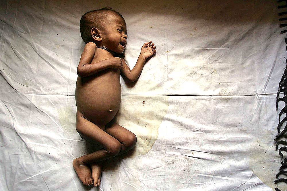 A Stunted Growth Story
