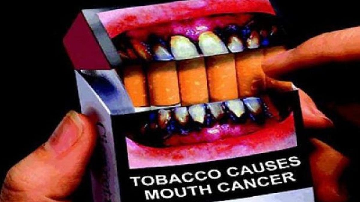 Tobacco causes cancer. 