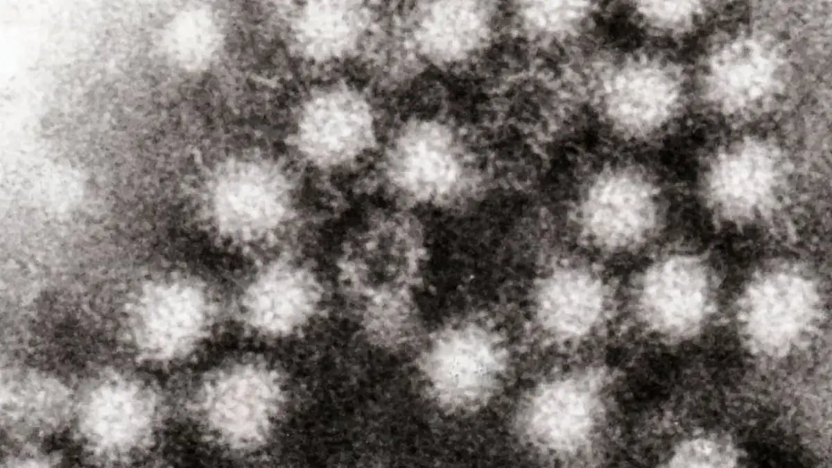 Norovirus particles as seen under a microscope