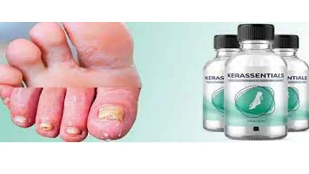 Kerassentials