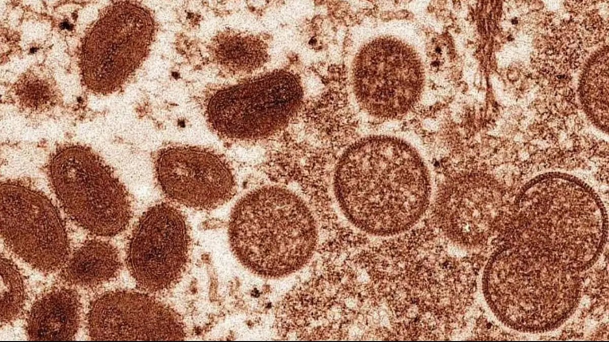 Monkeypox Case In Delhi Takes India's Tally To 4; Centre Holds High-Level Review Meeting