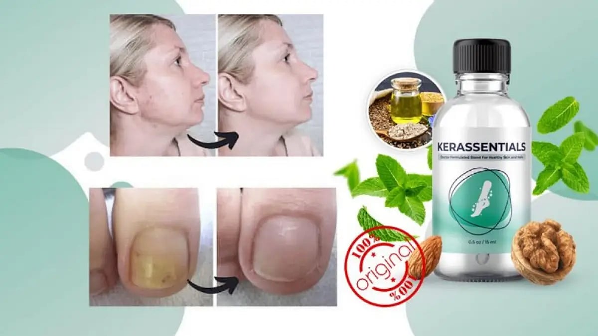 Kerassentials