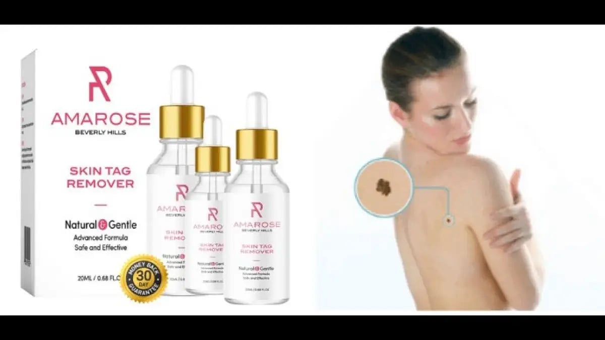 Amarose Skin Tag Remover
