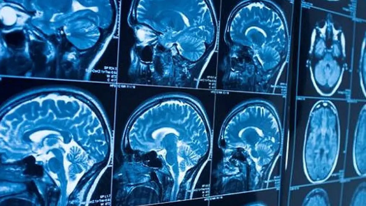 Due to brain mapping device, treatment for brain tumour and other brain surgeries have become safer 