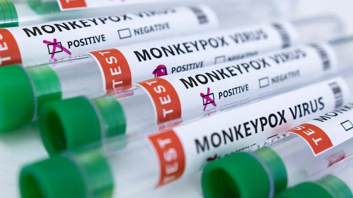 Health Insurance Policy Cover Monkeypox