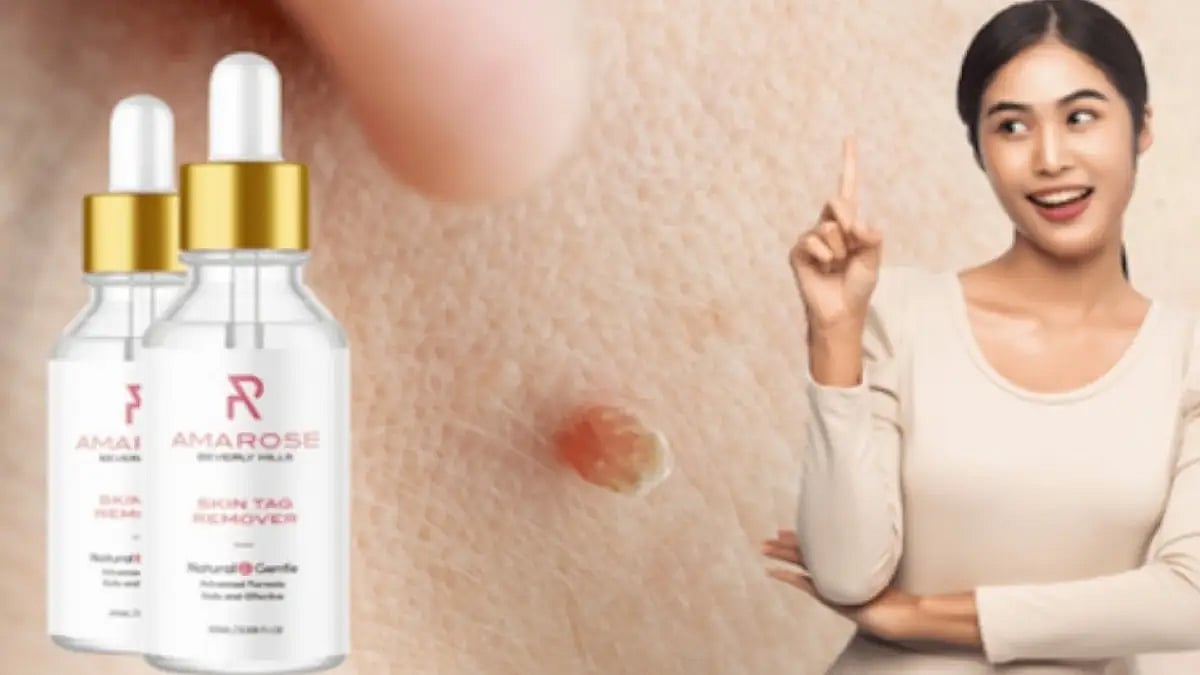Amarose Skin Tag Remover