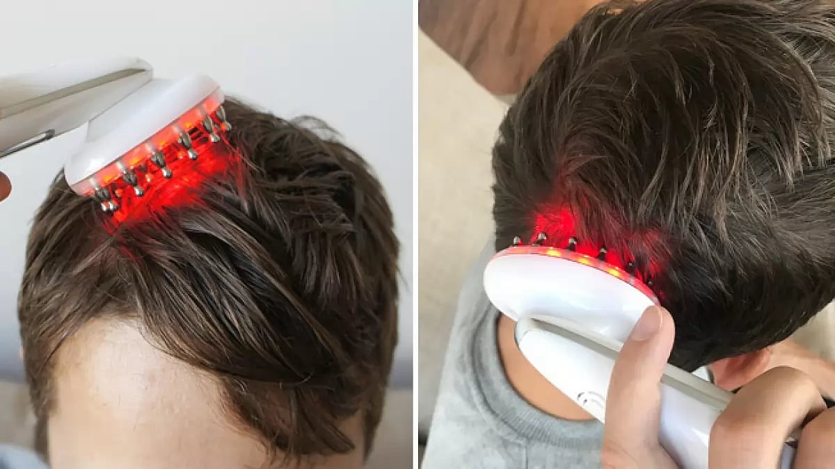 VitaHair Reviews