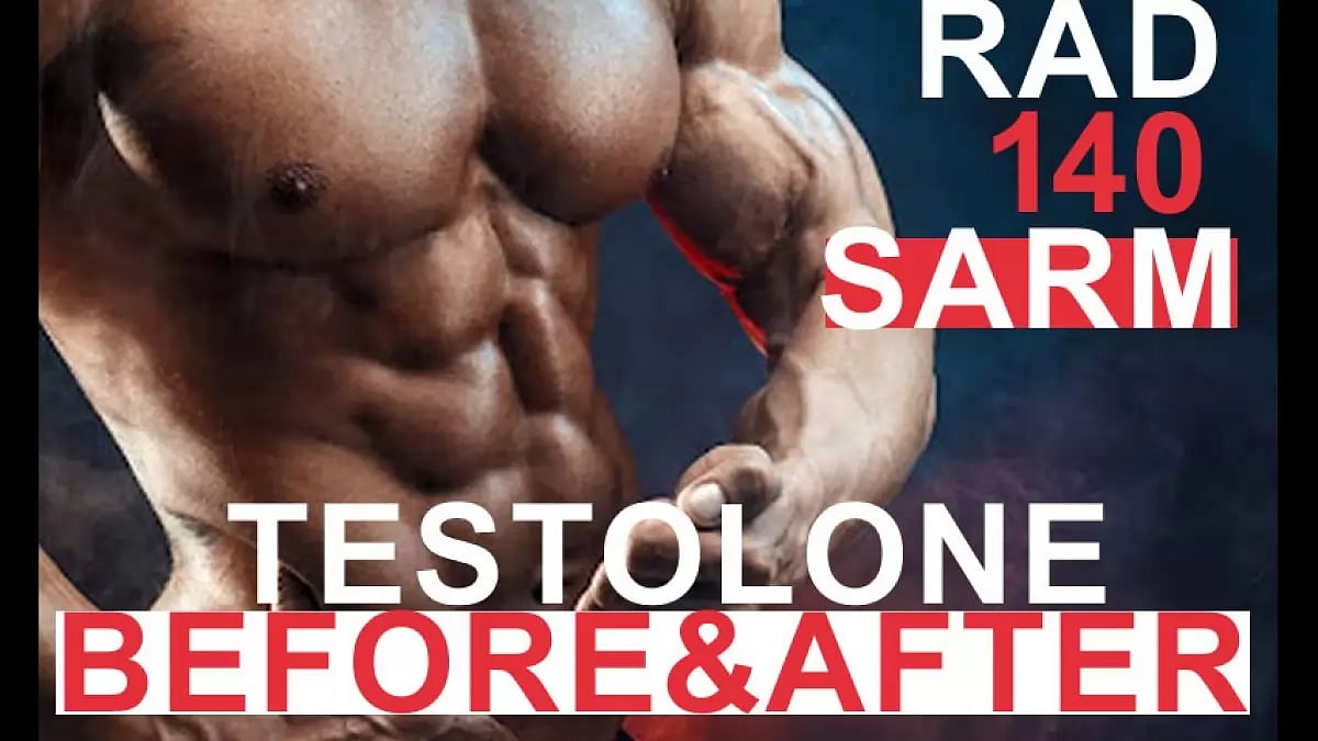 Rad 140 SARMs Review 
