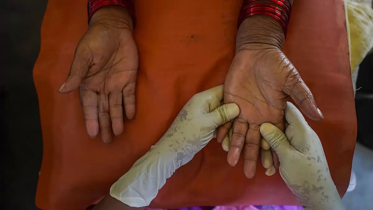 World Leprosy Day