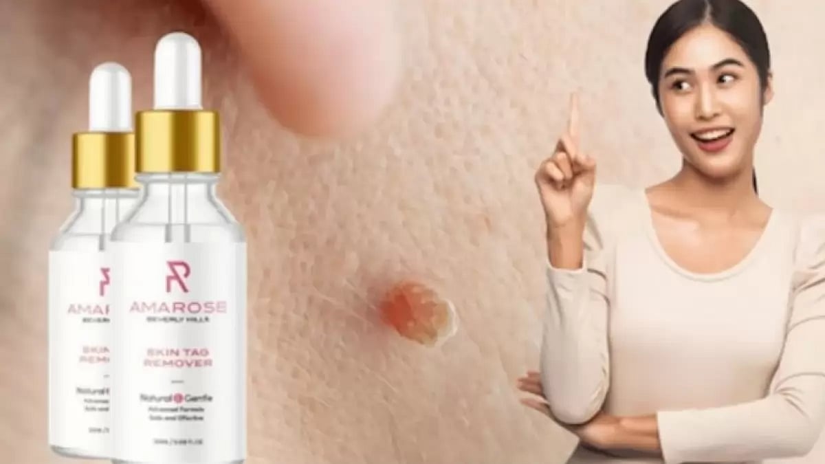 Perfect 10 Skin Tag Remover Reviews