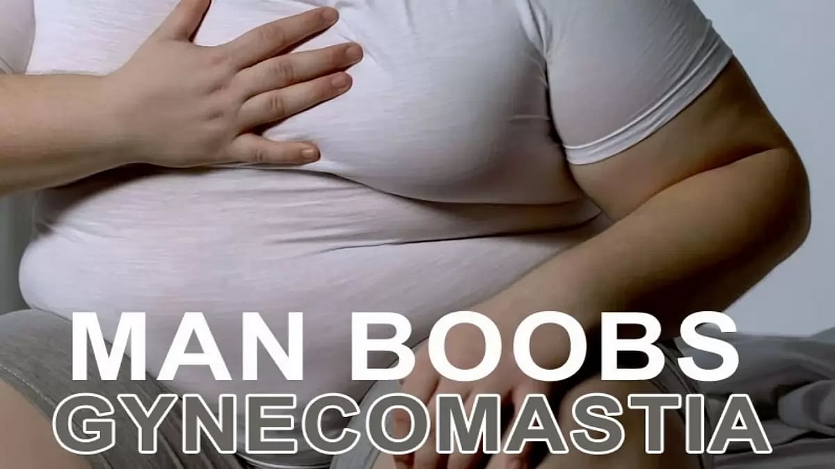 Man Boobs Gynecomastia Treatment