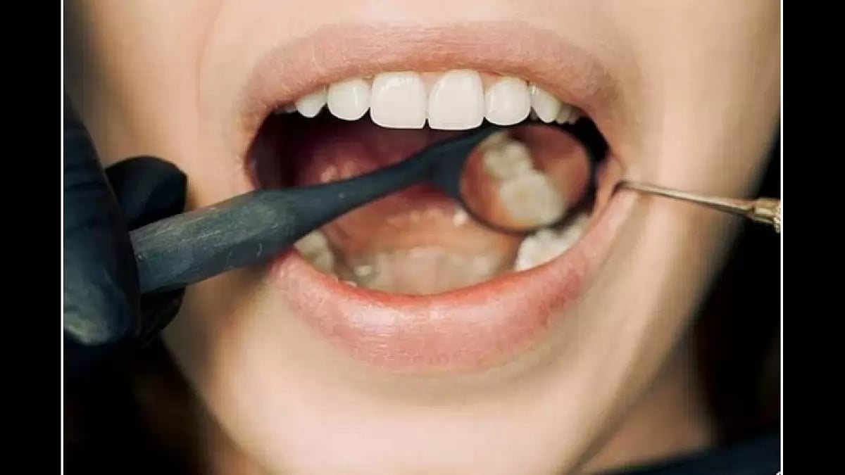  Dental Probiotics