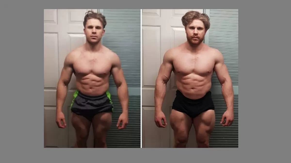 Trenbolone 